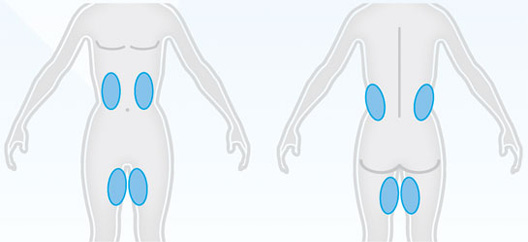 Coolfit Applicator image 2
